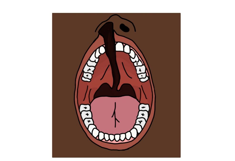 English Cleft Palate Speech Therapy: Evaluation & Treatment (Featured Image)